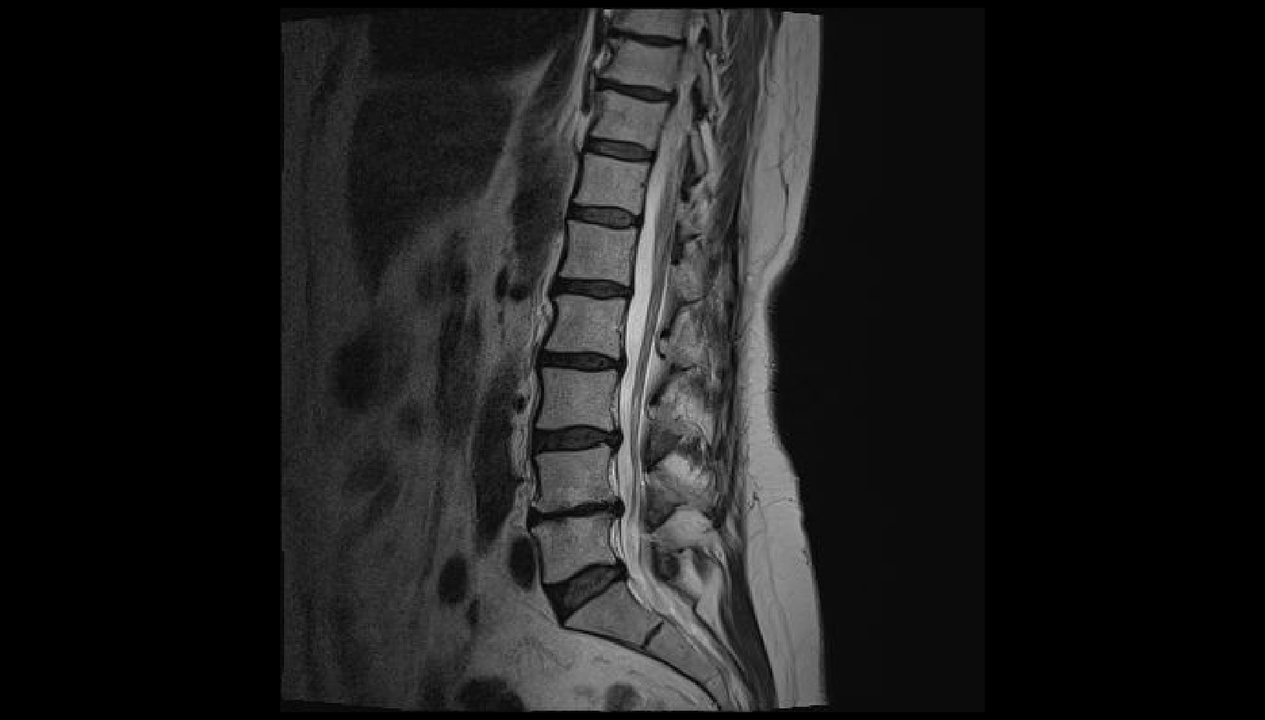 Diagnosticarea durerii de spate în regiunea lombară