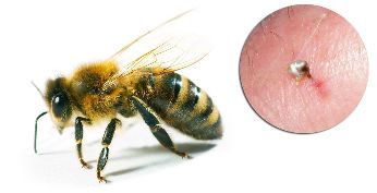 În componența Hondrostrong face parte din veninul de albine, care îmbunătățește procesele metabolice în țesuturi
